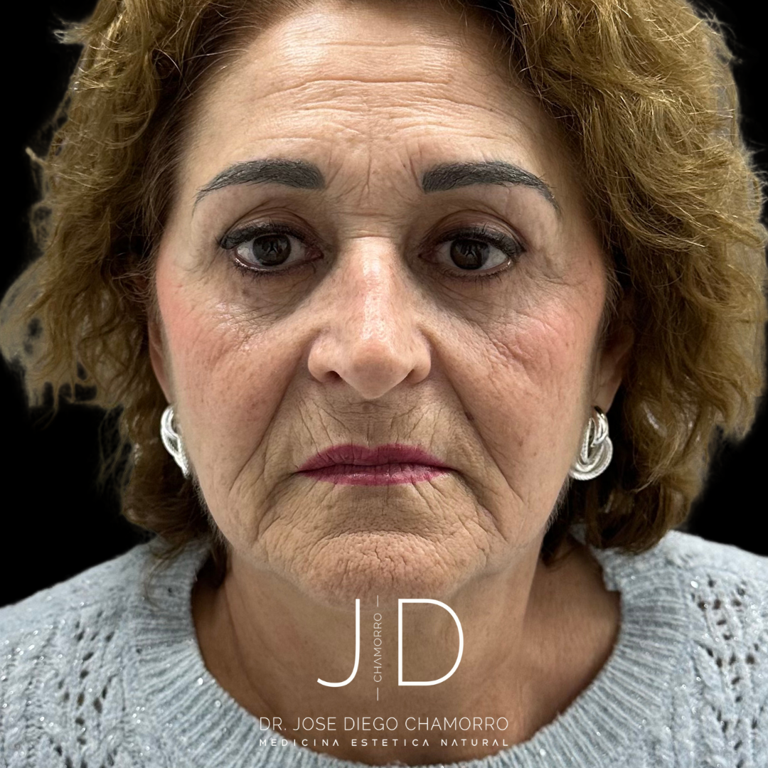 Diseño sin título - 1